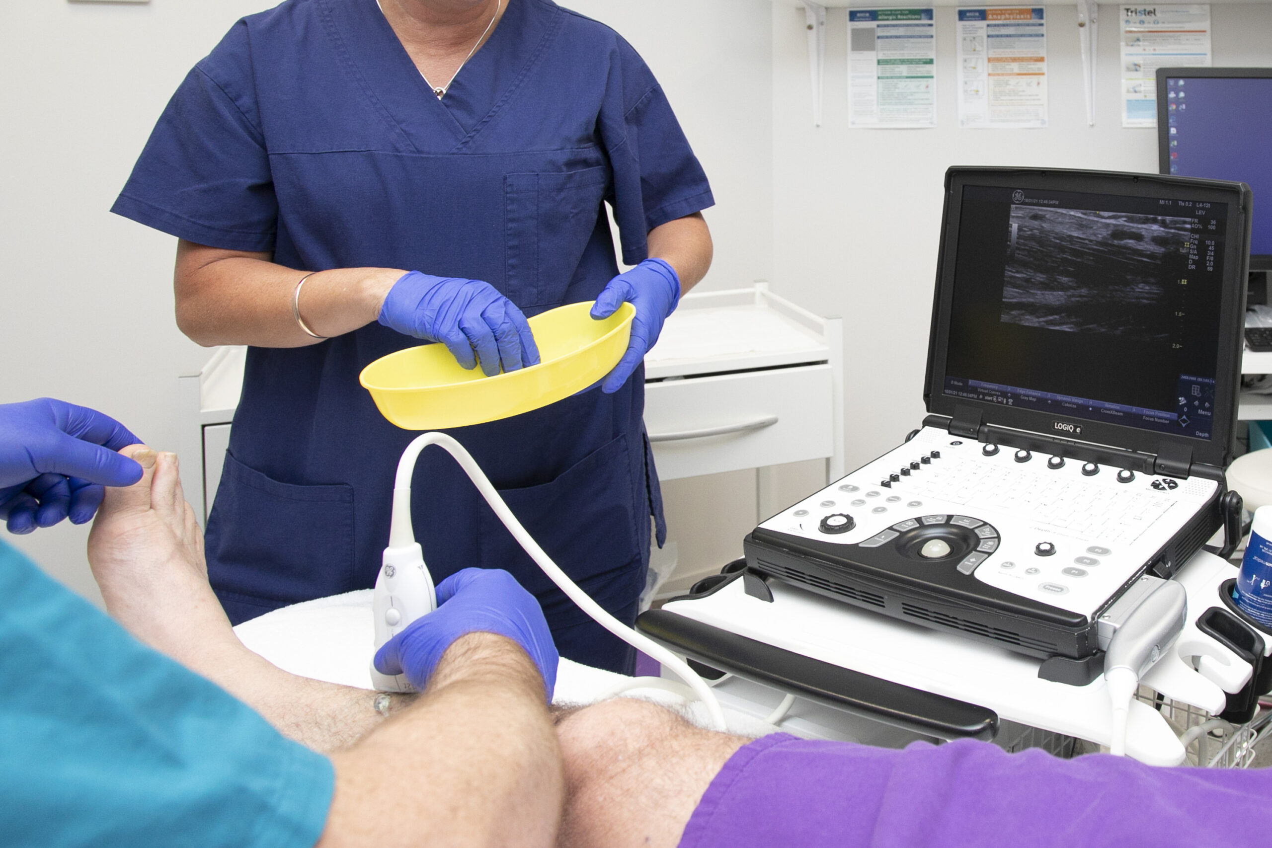 Your vascular specialist monitors your vein treatment using ultrasound.