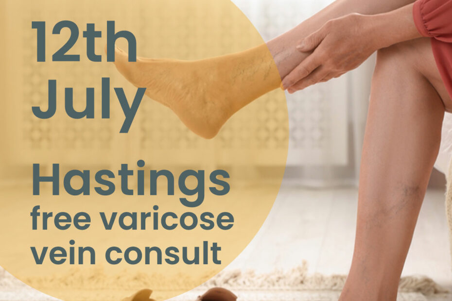 Woman,Sitting,Legs,Crossed,Varicose,Veins,Painful,Free,Nurse,Consultation,Hastings,12,July.