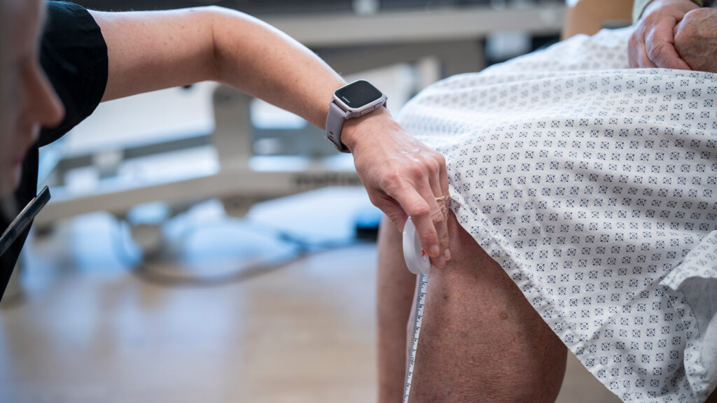 Nurse,Measuring,Leg,Of,Woman,With,Varicose,Veins,For,Compression,Stockings.