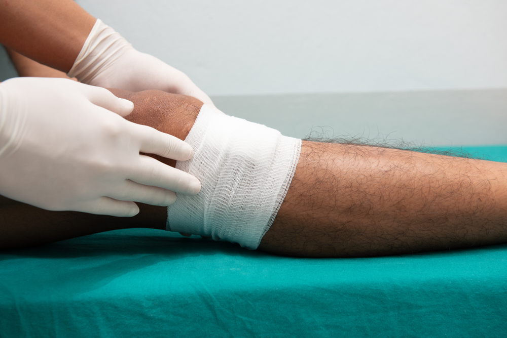 Nurse,Bandages,Ulcer,On,Male,Patient,With,Old,Varicose,Veins.